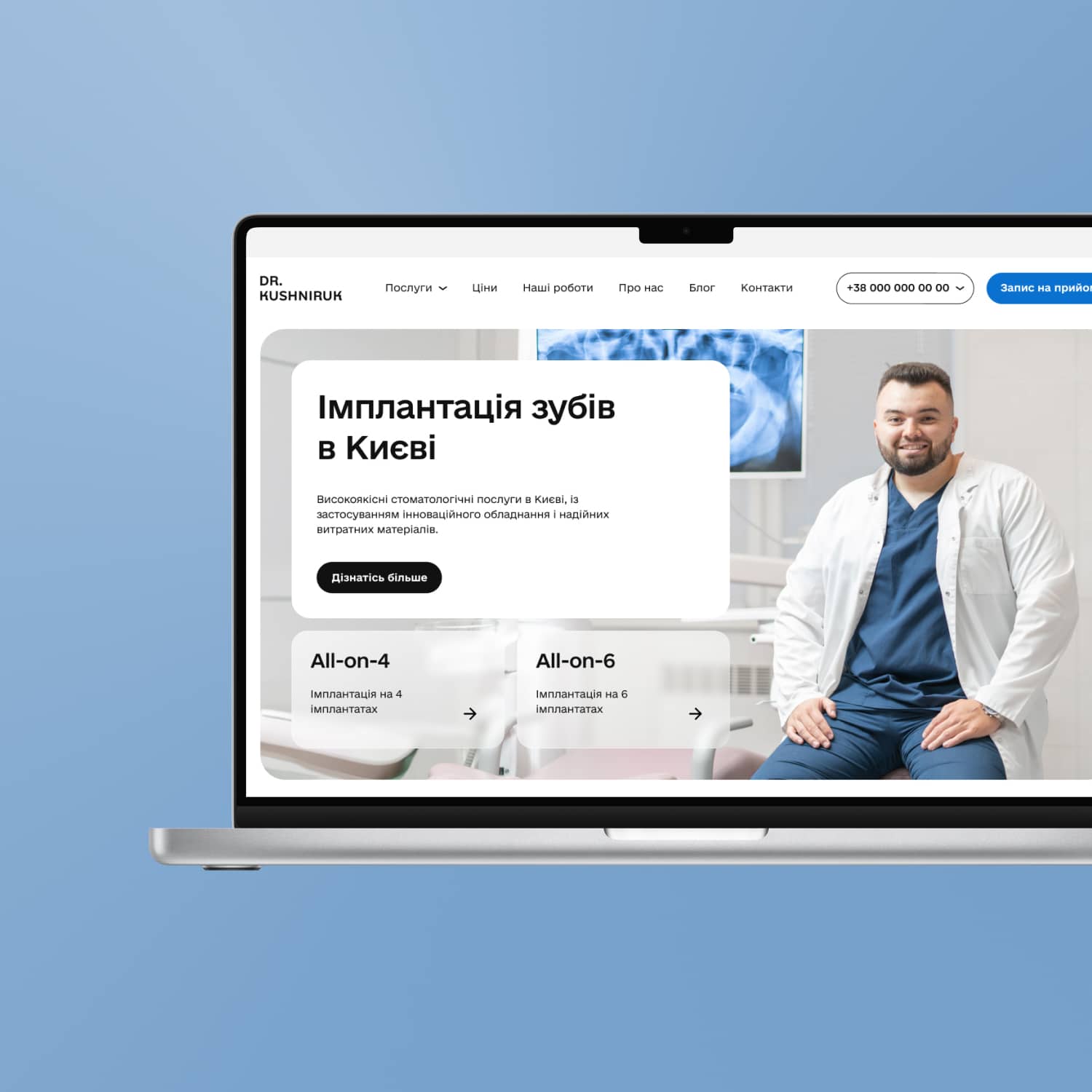 SEO implantatsiya.kyiv.ua